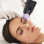 Morpheus8® Visage & Cou – Microneedling + Radiofréquence