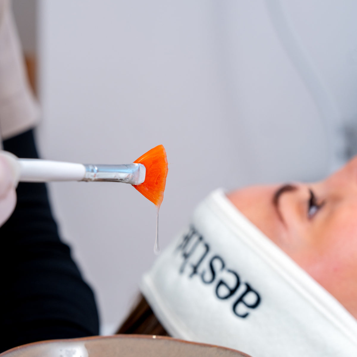 Peeling a Medida – Manchas, Poros y Luminosidad