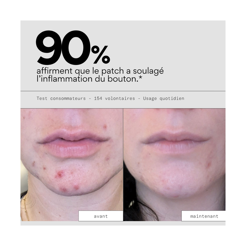 Clear Out - Patchs Boutons Hydrocolloïde