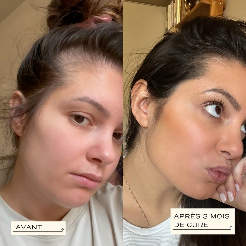 Grow - Santé & Croissance Des Cheveux