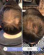 Grow Perfect™ Shampoo