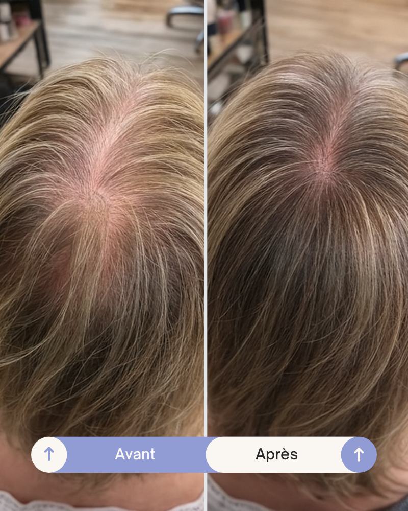 Grow Perfect™ Shampoo