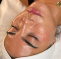 Miracle Face Renata França E Lifting Coreano