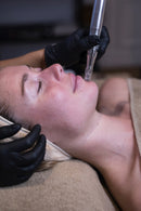 Needling Skin Repair personnalisé - Nettoyage de peau et coup d'éclat - 1 Séance 1h15