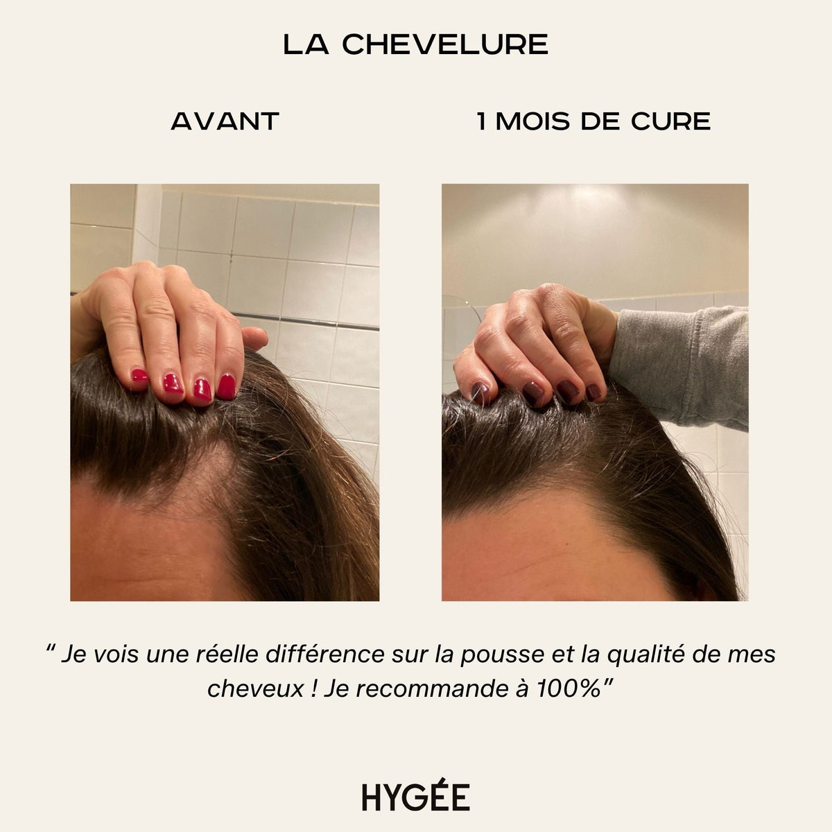 "El Cabello"
