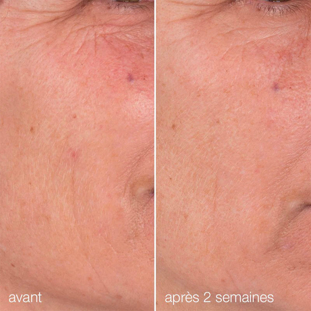 Cofre Am Radiance + Pm Renewal | Dúo Luminosidad + Regeneración