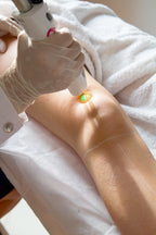 Pack 3 Séances Laser — Jambes Complètes