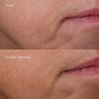 Phyto-Nature Firming Serum | Sérum reafirmante y tensor