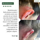 Ce protocole anti-psoriasis et plaques sèches de MakeMyMask est révolutionnaire, voici mon avant-après