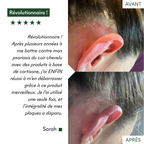 Protocole Anti-PSO & Plaques