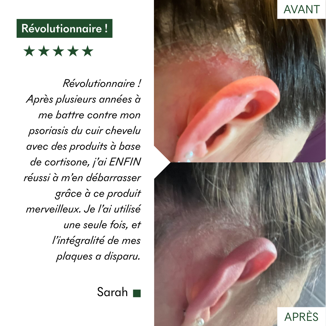 Protocole Anti-PSO & Plaques