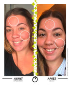 Serum MAKE MY REDNESS DISAPPEAR! Before After - Garancia Laboratory 