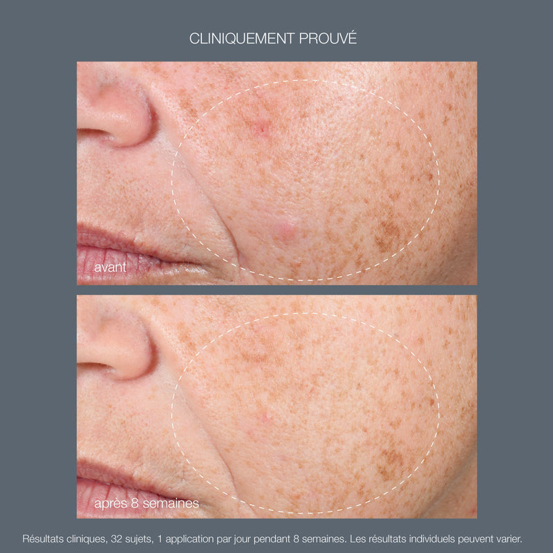 Huile De Nuit Purifiante Au Rétinol