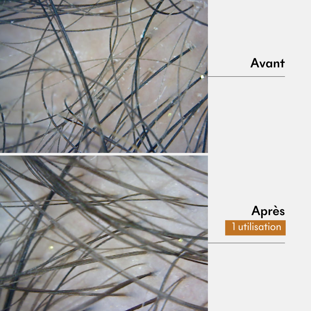 Fine hair mask result