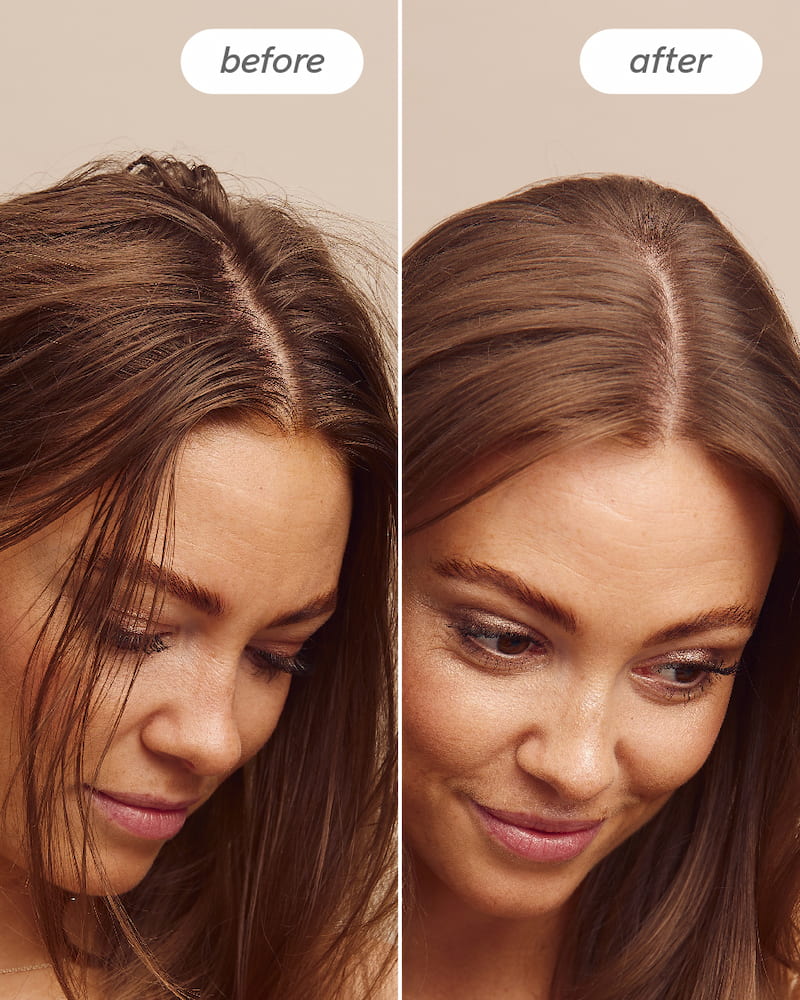 Scalp Delight™ Detox Scrub