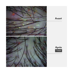 Résultat masque cheveux gras