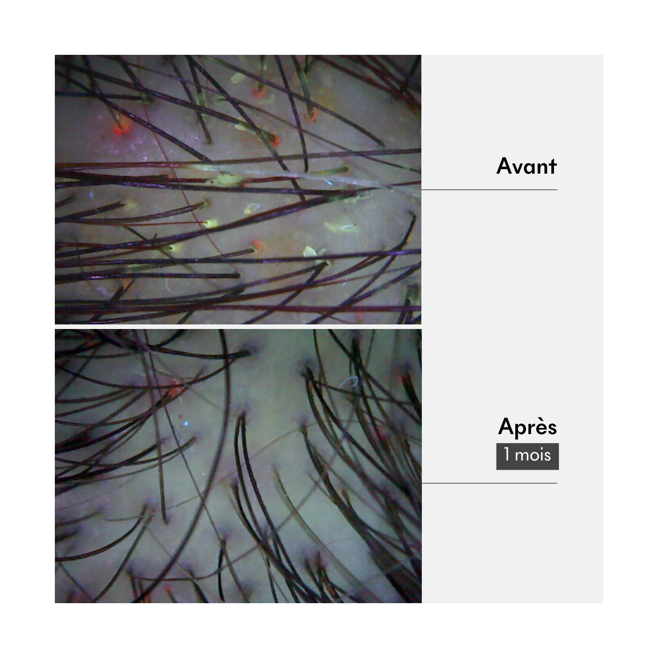 Résultat masque cheveux gras