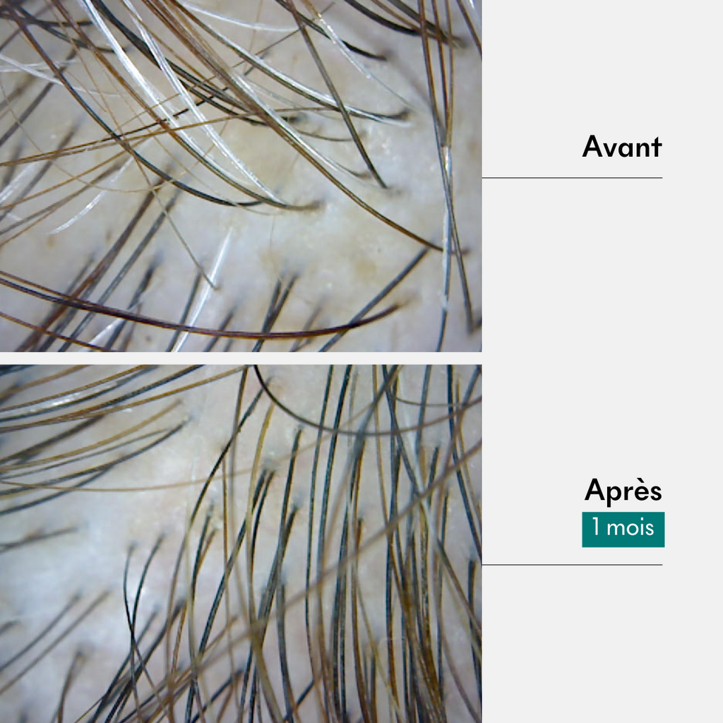Results of anti-white hair pre-shampoo treatment