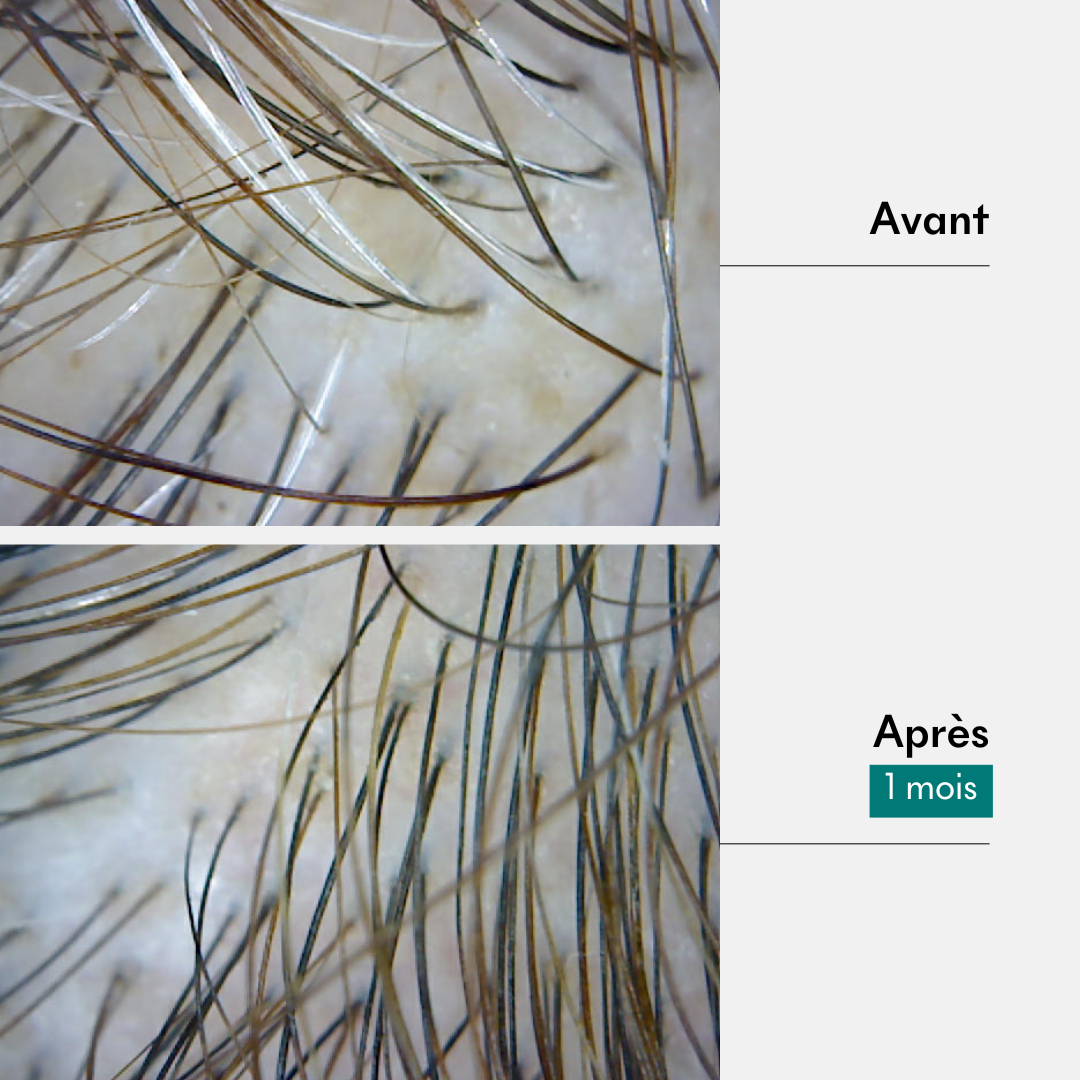 Results of anti-white hair pre-shampoo treatment