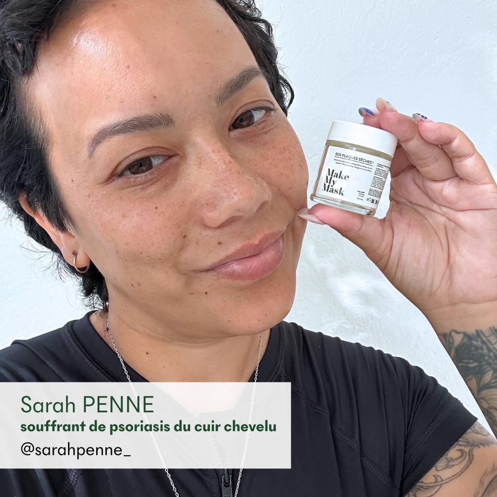 Sarah Penne, suffering from scalp psoriasis, recommends MakeMyMask's SOS Dry Patches anti-psoriasis supplement