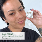 Sarah Penne, suffering from scalp psoriasis, recommends MakeMyMask's SOS Dry Patches anti-psoriasis supplement
