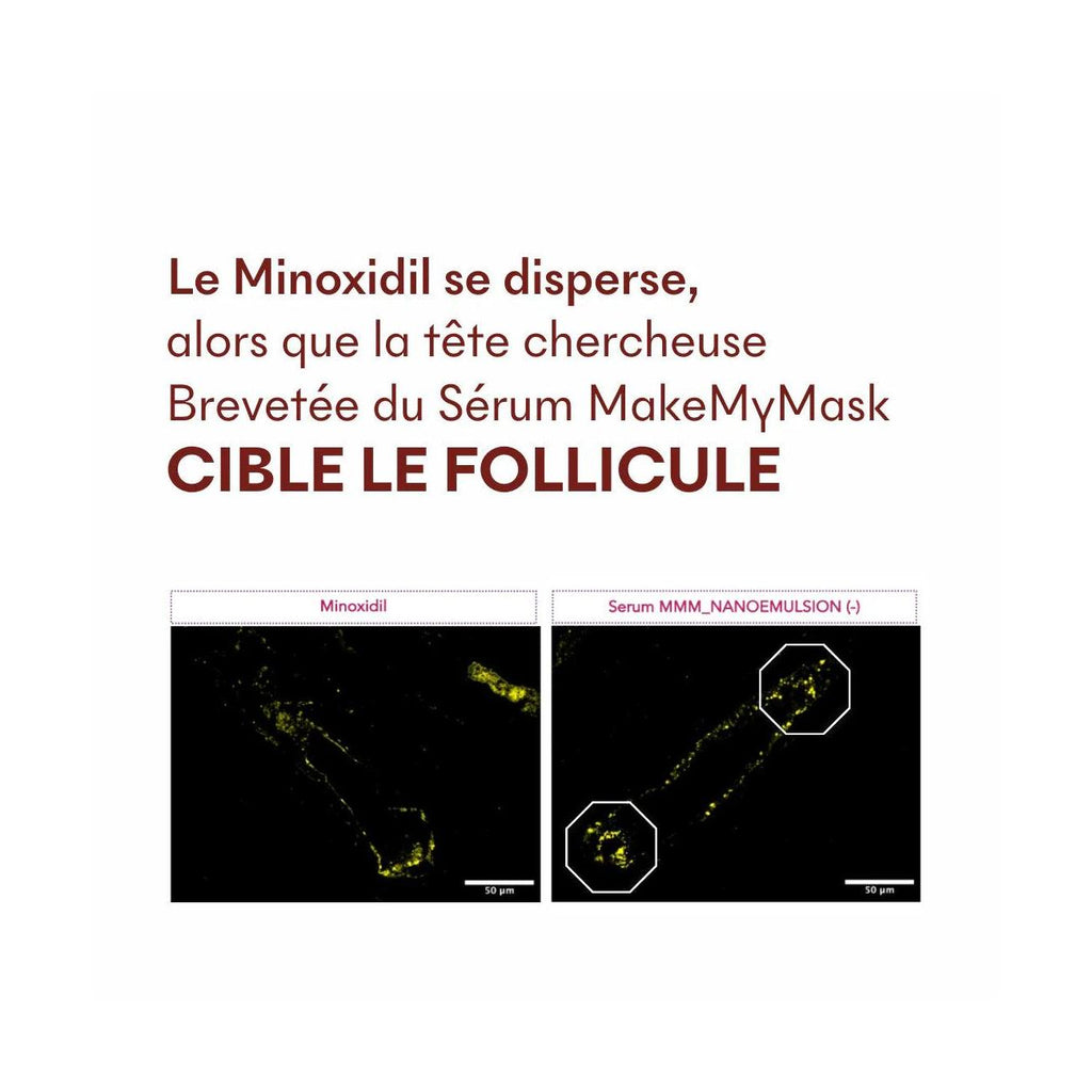 Sérum Anti-Chute Tricho-Boost
