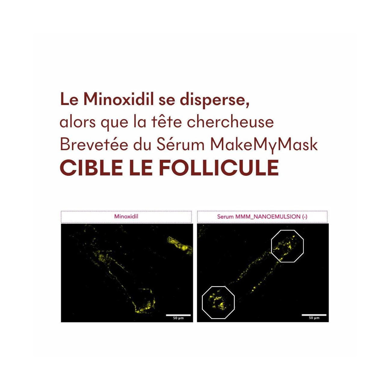 Sérum Anti-Chute Tricho-Boost