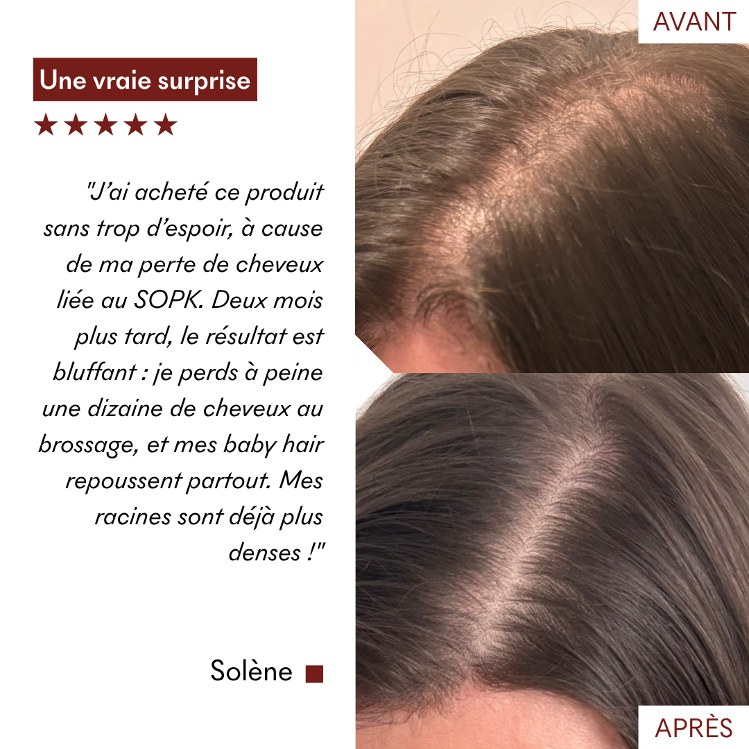 Growth & Anti-Hair Loss Mud