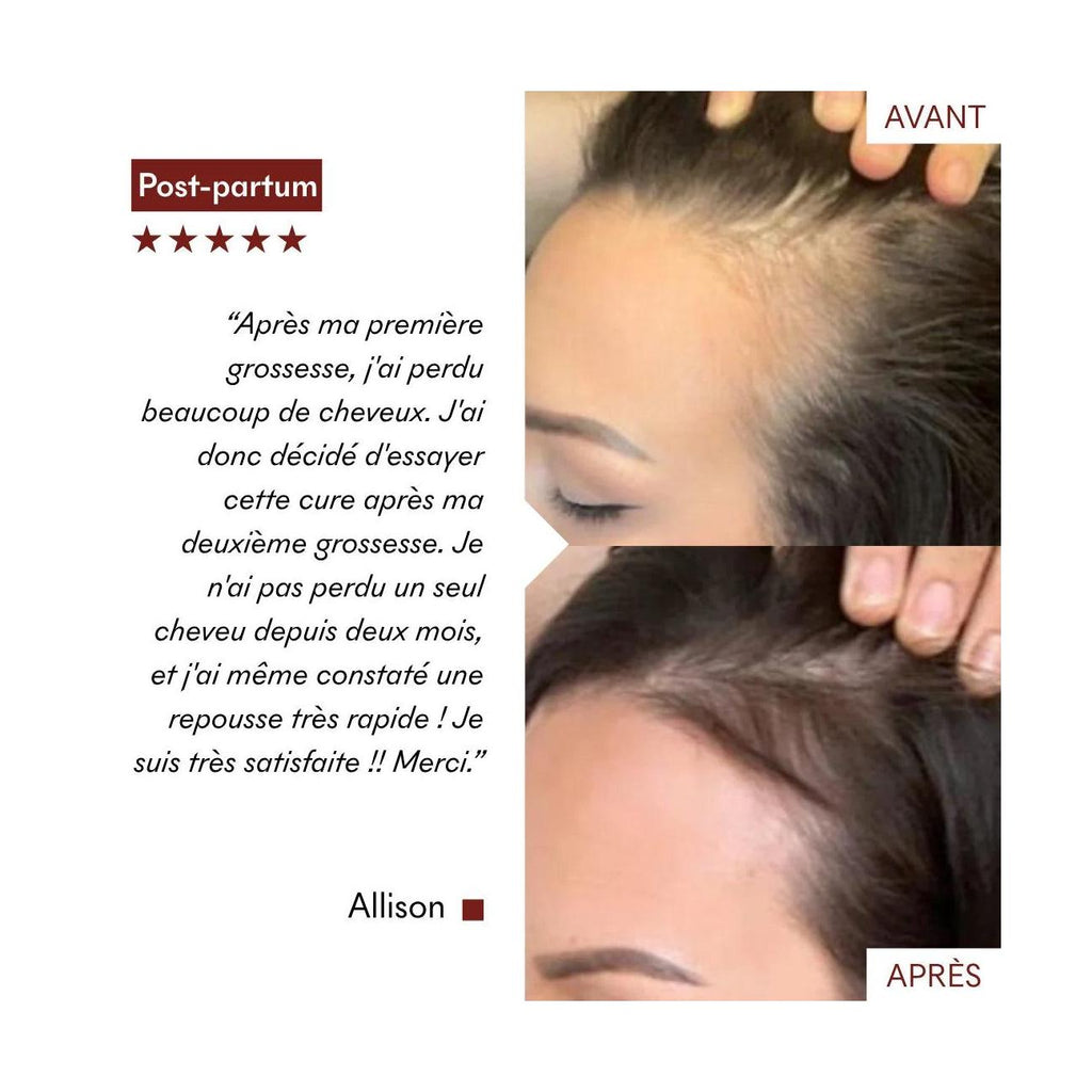 Sérum Anti-Chute Tricho-Boost
