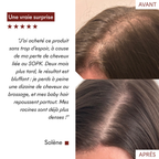 Anti-Hair Loss Serum Tricho-Boost