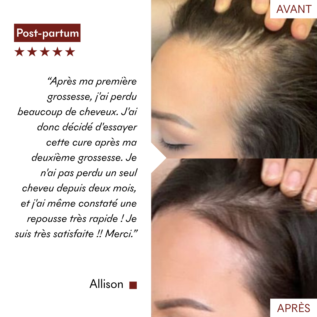 Growth & Anti-Hair Loss Mud