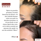 Anti-Hair Loss Serum Tricho-Boost