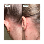Exfoliante Activo Anticaspa