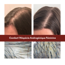 Protocole Anti-Chute Hormonale