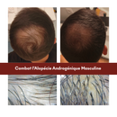 Protocole Anti-Chute Hormonale