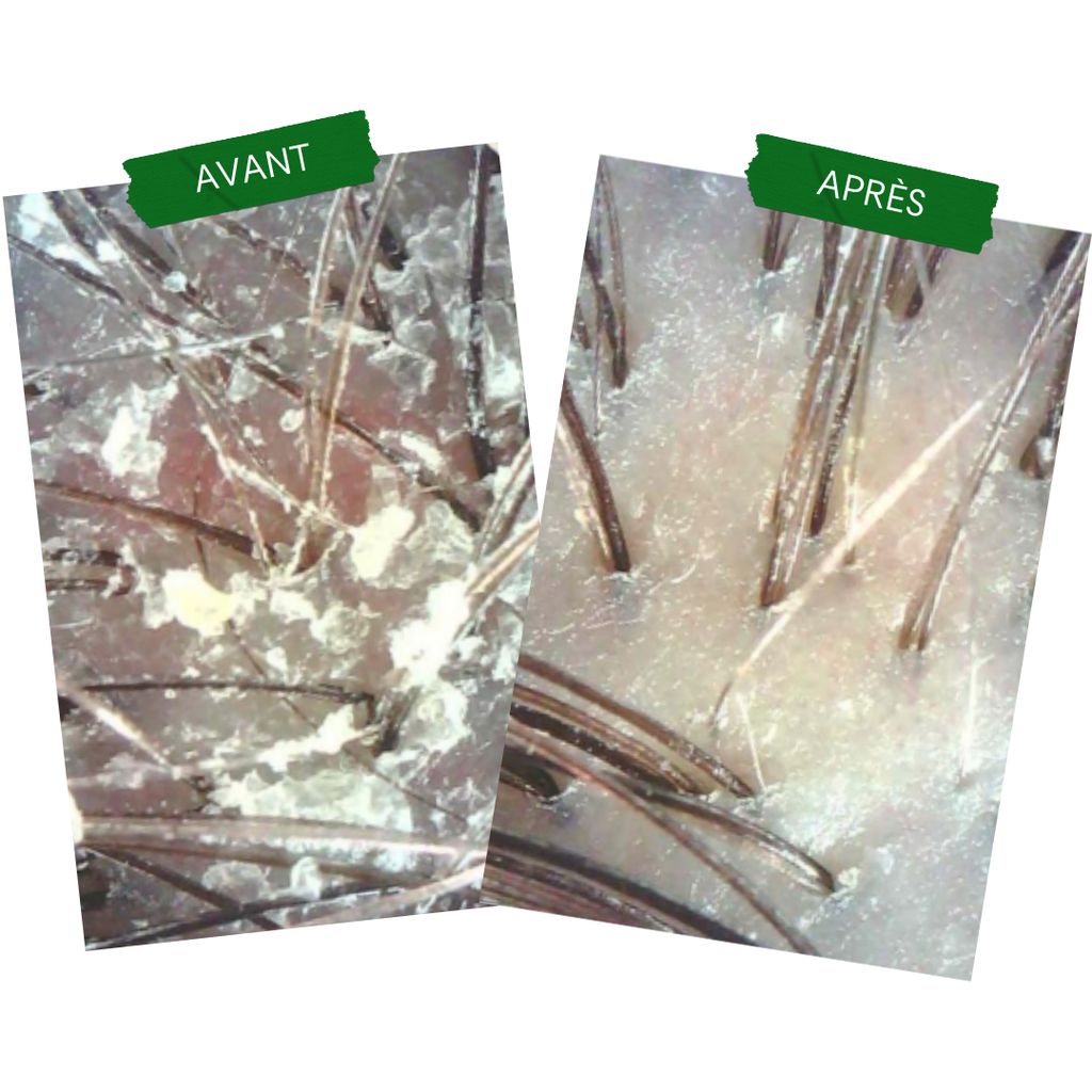 Anti-Pso & Patches Concentrate