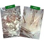 Anti-Pso & Patches Concentrate