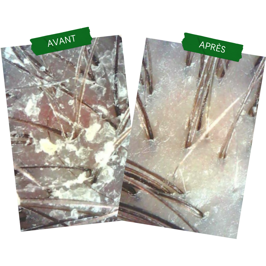 Anti-Pso & Patches Concentrate