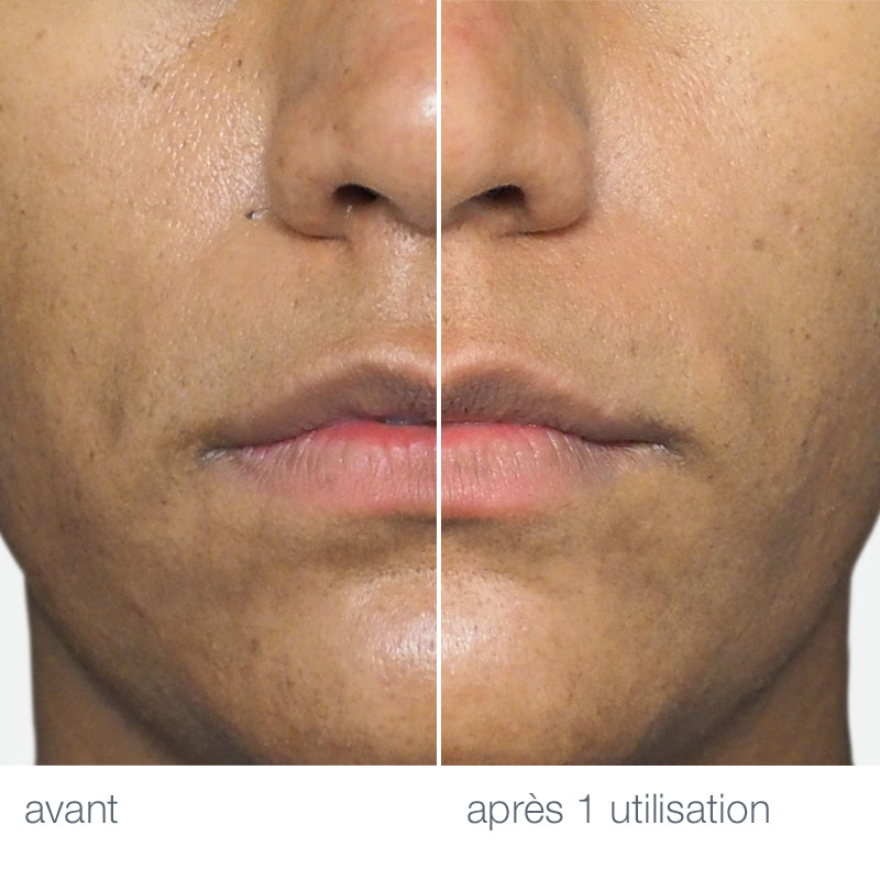 antes y después