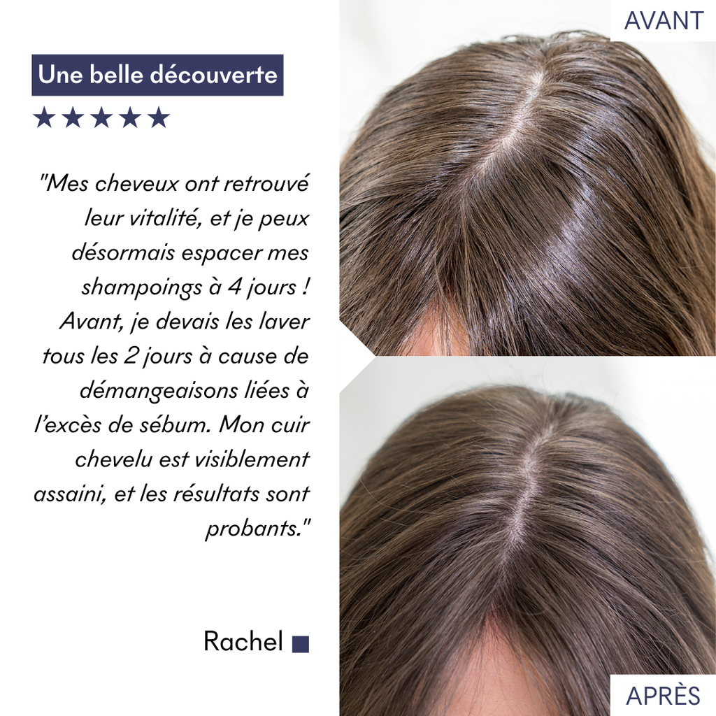Shampoo for Oily Hair Tricho-Detox pH5