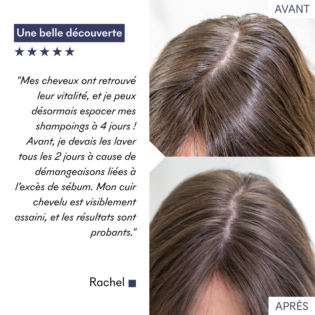 Shampoo for Oily Hair Tricho-Detox pH5