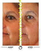 Garancia Anti-Aging & Anti-Wrinkle Laboratory [Polar STAR] - face before after application of serum