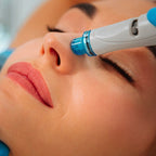 Trattamento Hydrafacialist