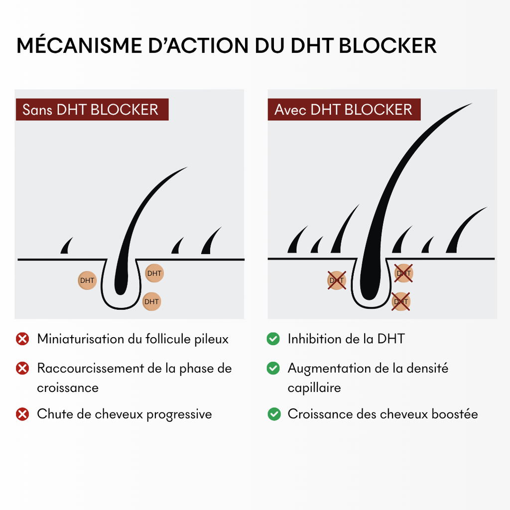DHT Blocker Hormonal Anti-Hair Loss 3 Months
