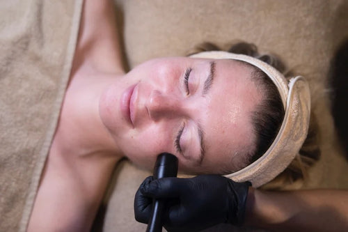 Radiofrecuencia Todo Rostro (Mujeres y Hombres)