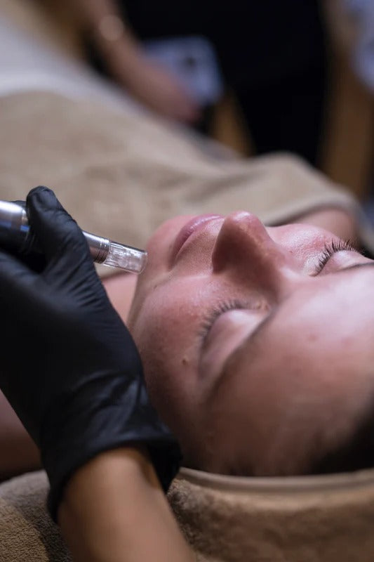 Needling Skin Repair (Donna & Uomo)