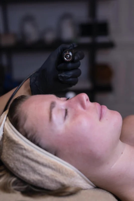 Full Face Radiofrequency (Women & Men)