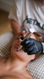 Face Reboot: Radiofrequenza Viso & Needling Skin Repair (Donna & Uomo)