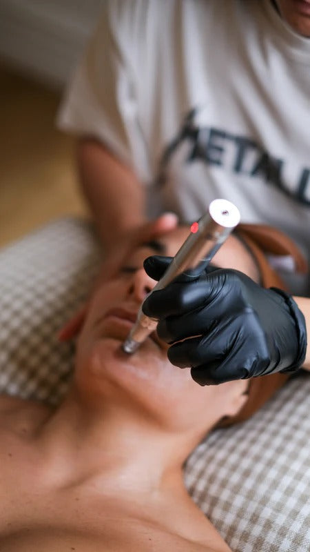 Face Reboot: Radiofrequenza Viso & Needling Skin Repair (Donna & Uomo)