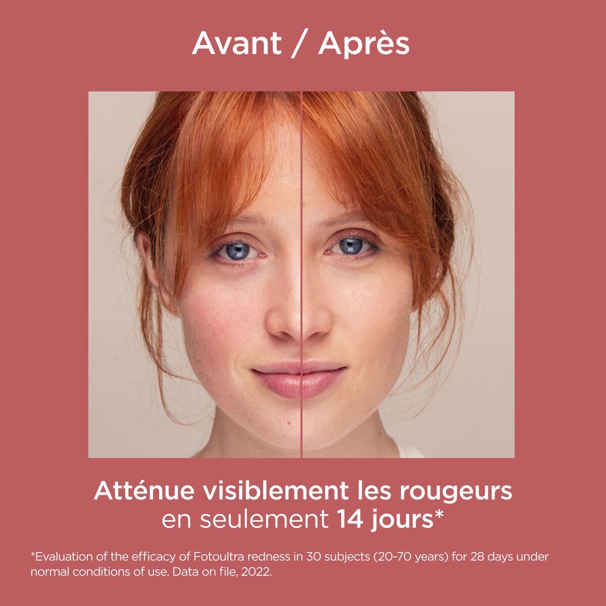 Redness Spf50+ Cr Solaire - 50Ml